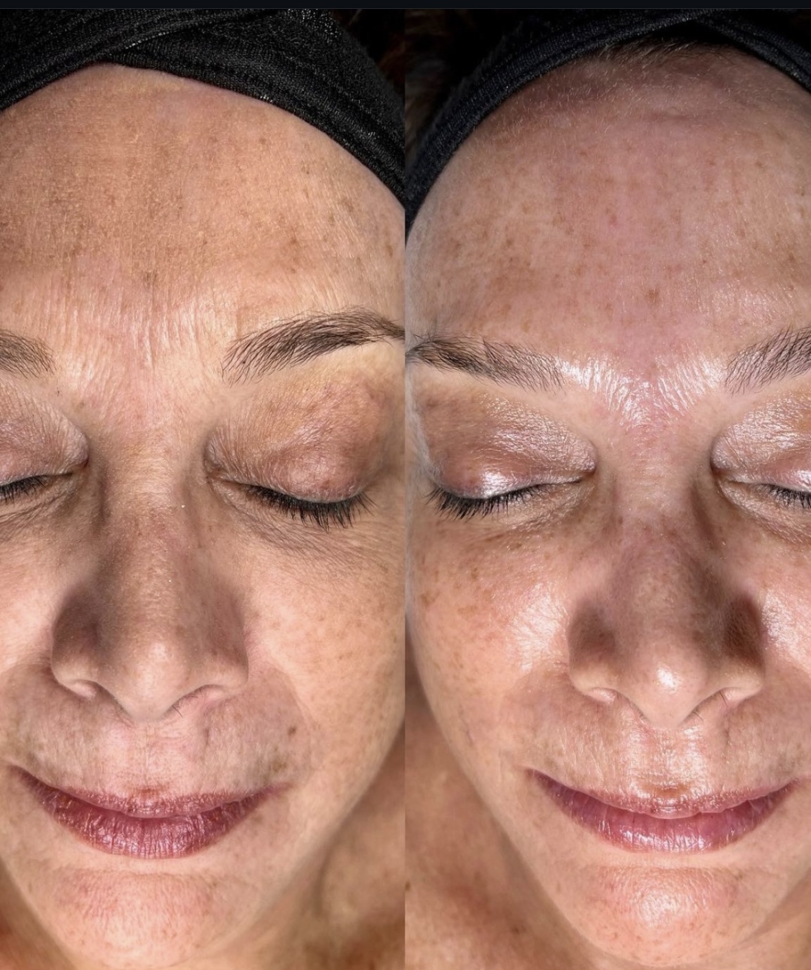 Brighter, More Even Tone