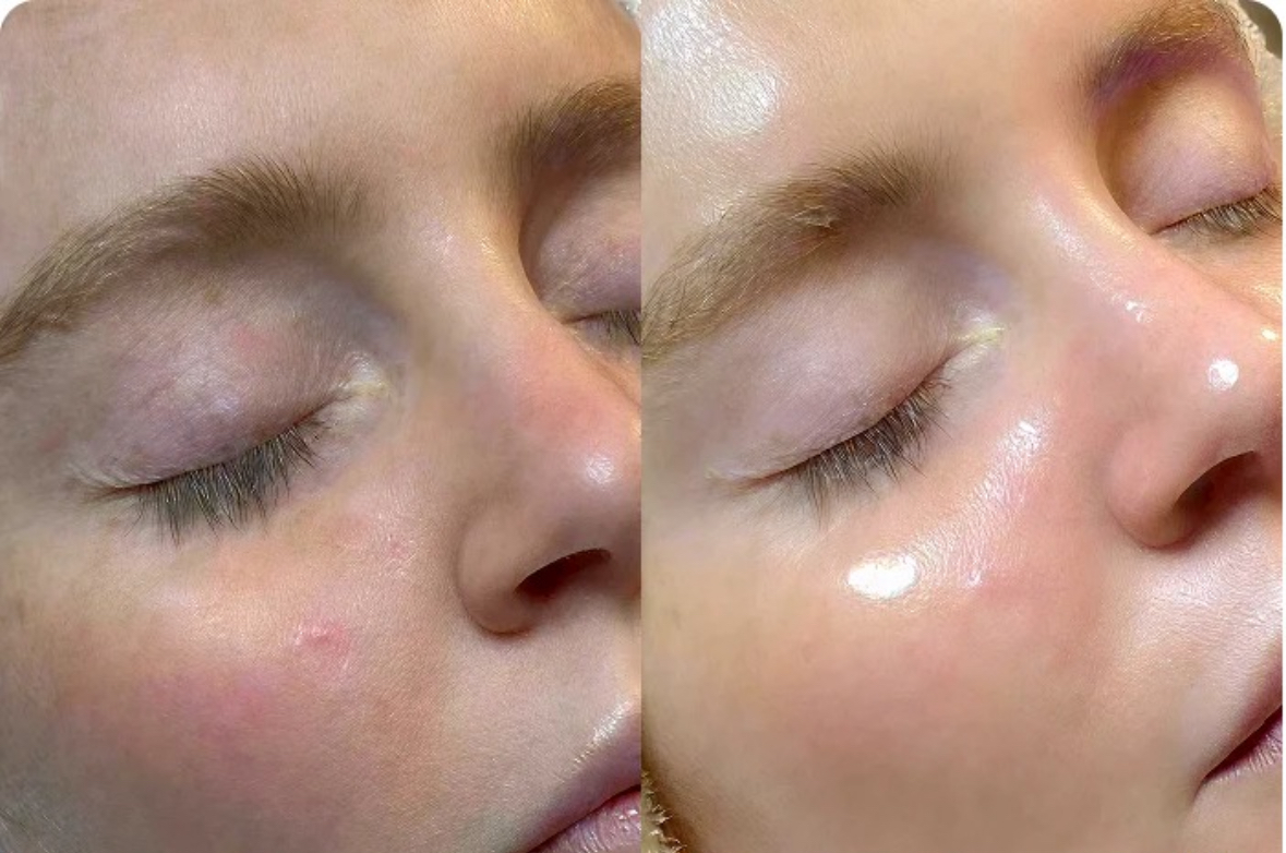 Glow Facial Experience